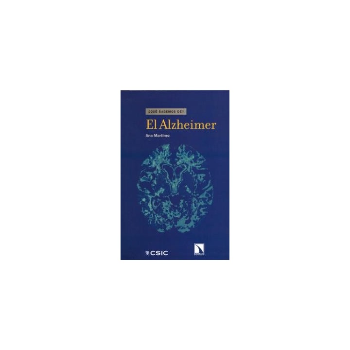 EL ALZHEIMER