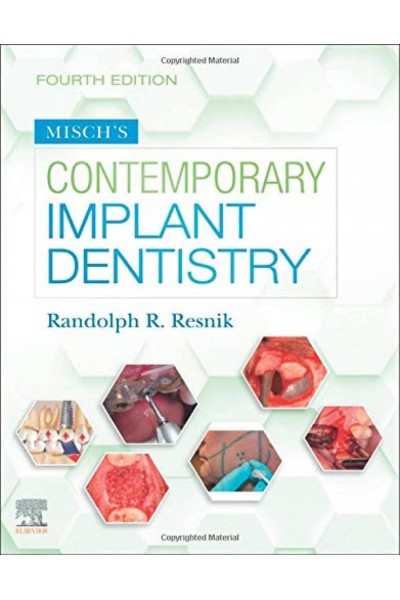 MISCH´S CONTEMPORARY IMPLANT DENTISTRY