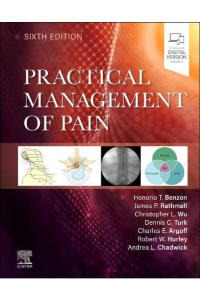 PRACTICAL MANAGEMENT OF PAIN