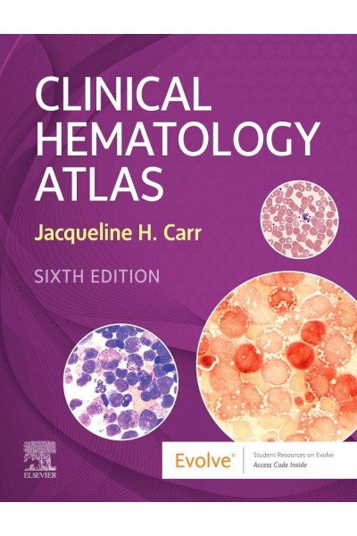CLINICAL HEMATOLOGY ATLAS