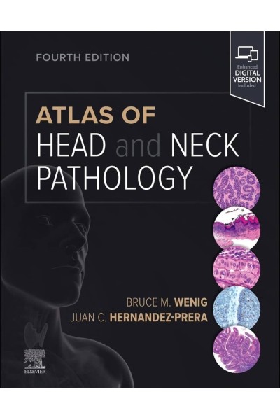 ATLAS OF HEAD AND NECK PATHOLOGY