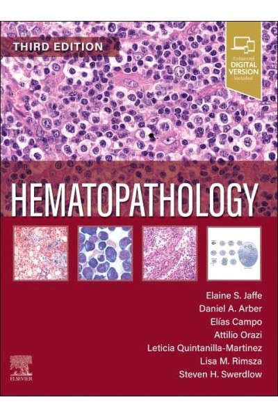HEMATOPATHOLOGY