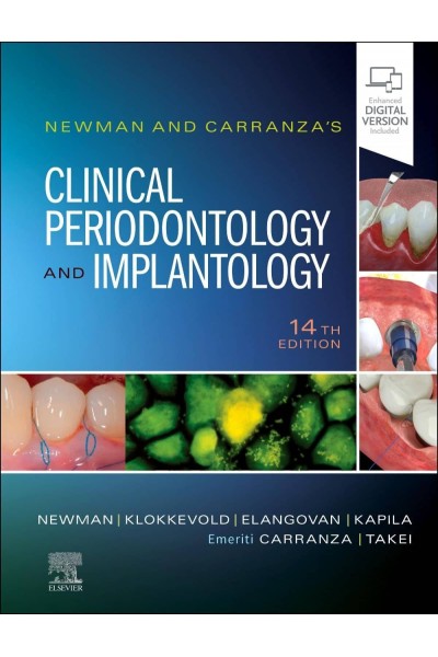 NEWMAN AND CARRANZA'S CLINICAL PERIODONTOLOGY IMPLANTOLOGY
