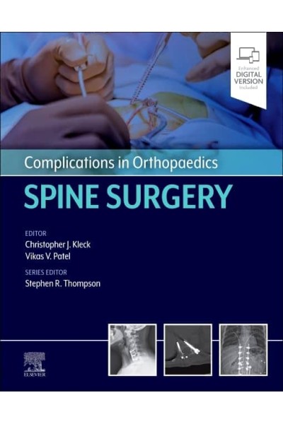 COMPLICATIONS IN ORTHOPAEDICS:SPINE SURGERY
