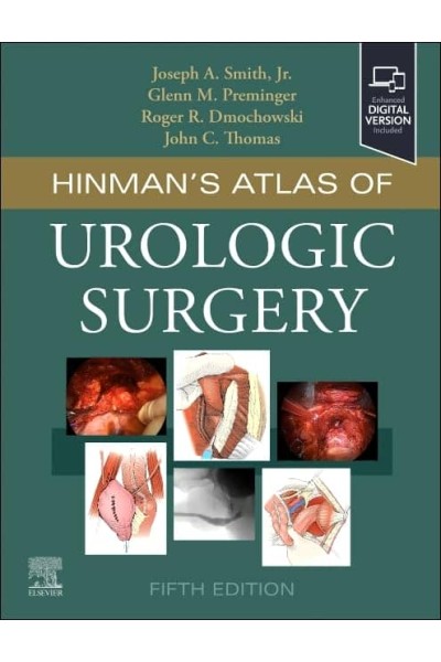 HINMAN´S ATLAS OF UROLOGIC SURGERY