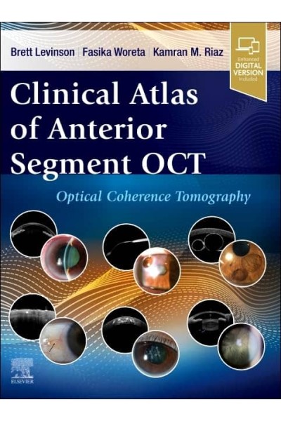 CLINICAL ATLAS OF ANTERIOR SEGMENT OCT:OPTICAL COHERENCE