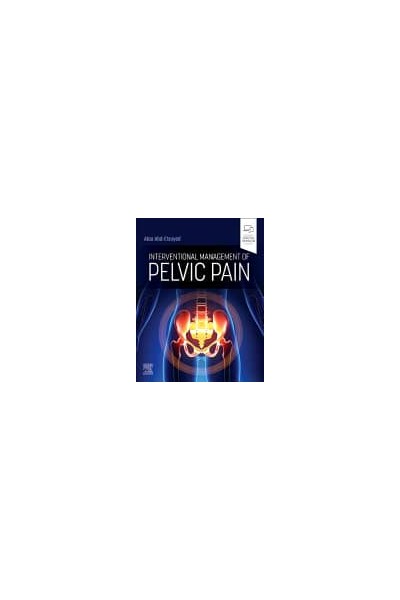 INTERVENTIONAL MANAGEMENT OF PELVIC PAIN