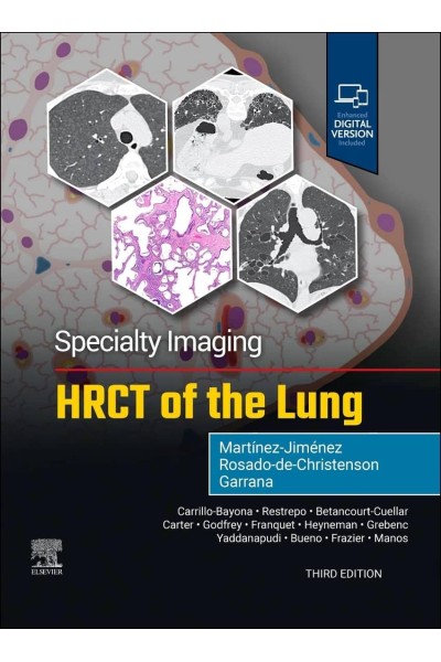 SPECIALTY IMAGING:HRCT OF THE LUNG
