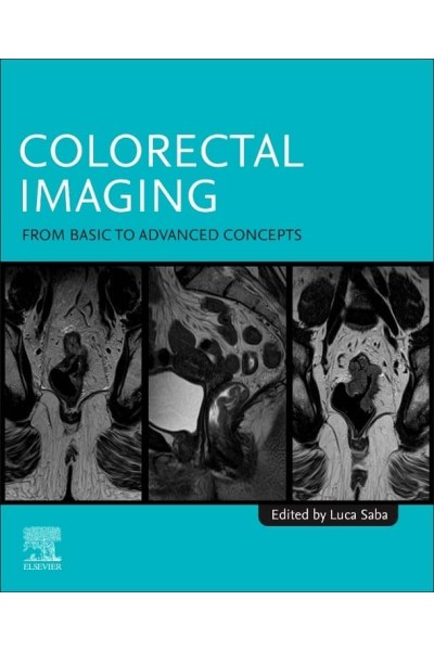 COLORECTAL IMAGING