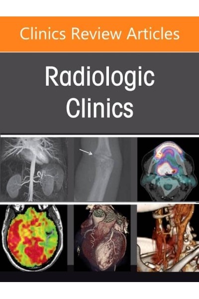 PULMONARY VASCULAR DISEASE, RADIOLOGIC CLINICS NORTH