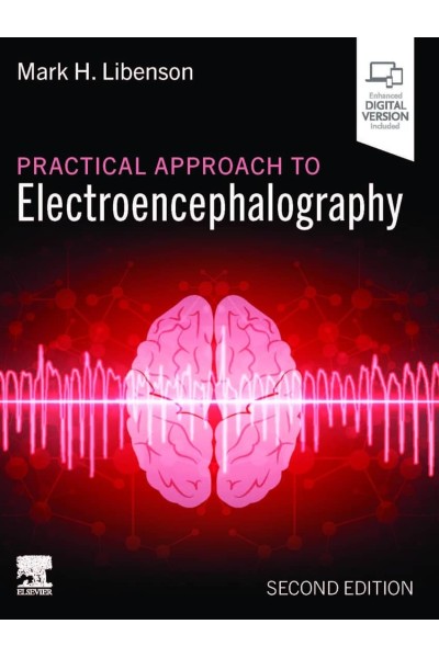 PRACTICAL APPROACH TO ELECTROENCEPHALOGRAPHT