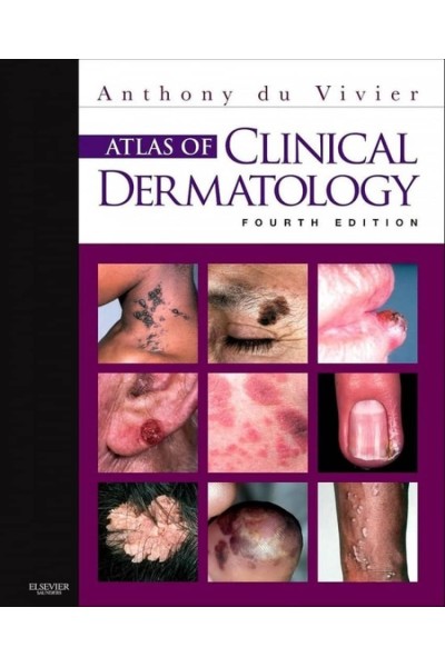 ATLAS OF CLINICAL DERMATOLOGY