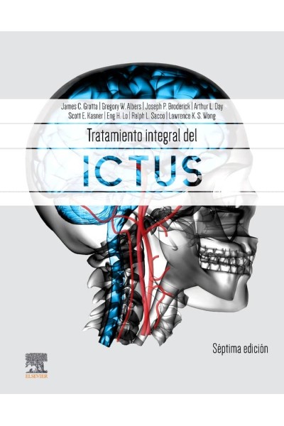 TRATAMIENTO INTEGRAL DEL ICTUS