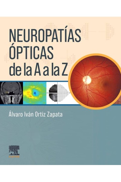 NEUROFTALMOLOGIA DE LA A A LA Z