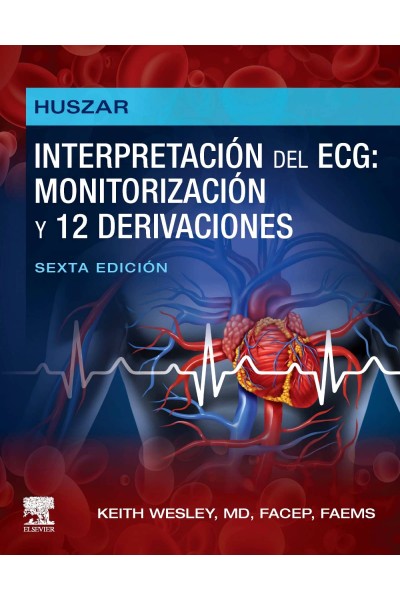 HUSZAR:INTERPRETACION ECG:MONITORIZACION 12 DERIVACIONES