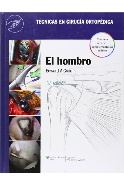 EL HOMBRO.