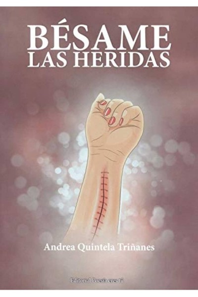 BESAME LAS HERIDAS