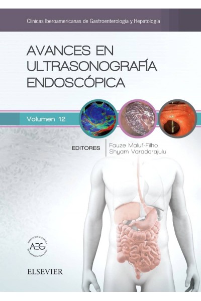 AVANCES EN ULTRASONOGRAFÍA ENDOSCÓPICA