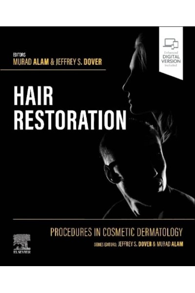 PROCEDURES IN COSMETIC DERMATOLOGY:HAIR RESTORATION