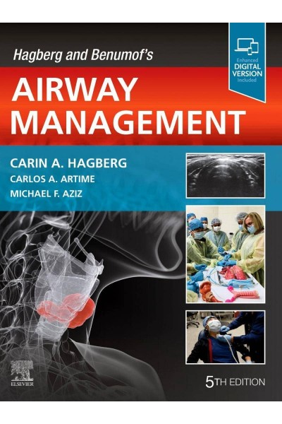 HAGBERG AND BENUMOF´S AIRWAY MANAGEMENT