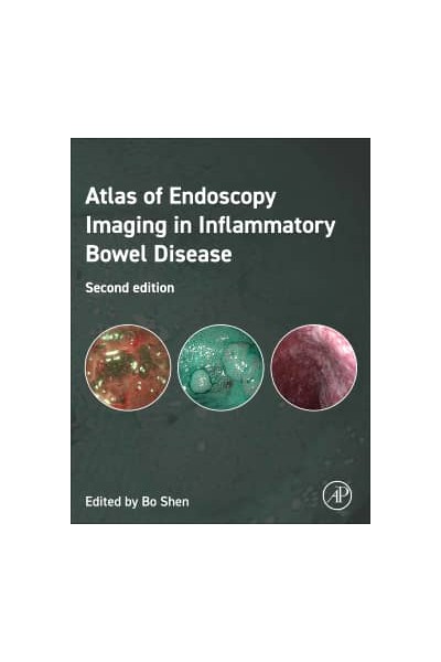 ESSENTIALS OF ENDOSCOPY IMAGING INGLAMMATORY BOWEL DISEASE