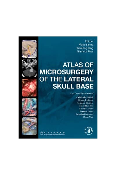 ATLAS OF MICROSURGERY OF THE LATERAL SKULL BASE