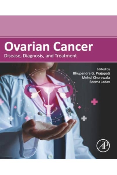 OVARIAN CANCER.DISEASE, DIAGNOSIS, AND TREATMENT