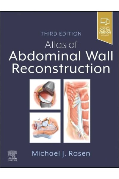 ATLAS OF ABDOMINAL WALL RECONSTRUCTION