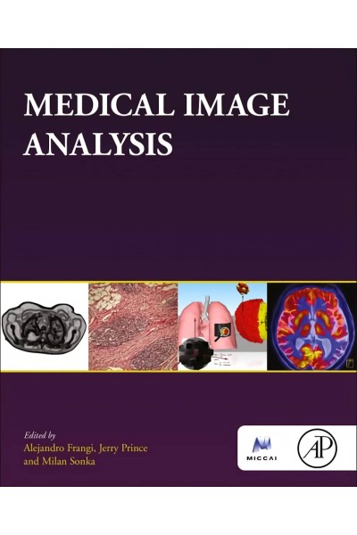 MEDICAL IMAGE ANALYSIS