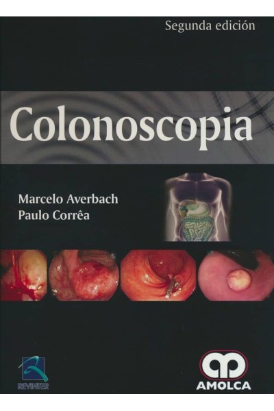 COLONOSCOPIA