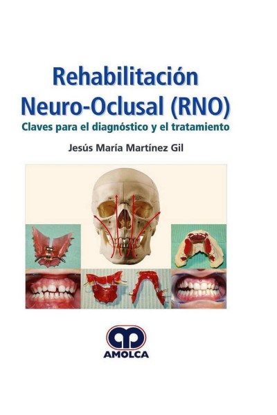 REHABILITACION NEURO-OCLUSAL RNO DIAGNOSTICO Y TRATAMIENTO